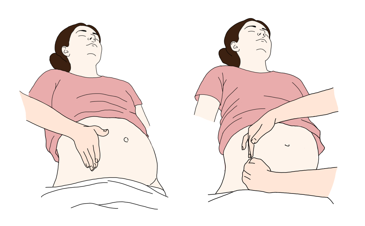 CPR Schwangere