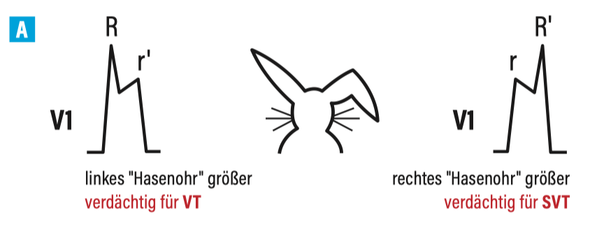 Breitkomplex