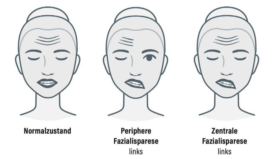 Facialis