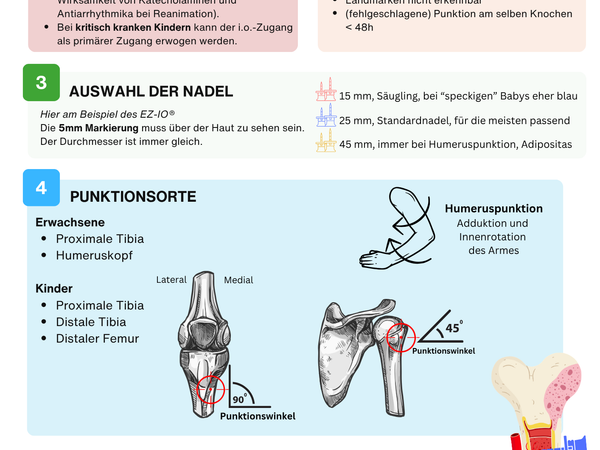 Intraossärer Zugang