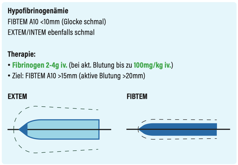 Hypofibrin