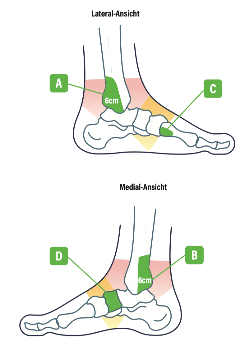 Ottawaankle