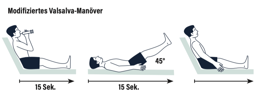 Revert