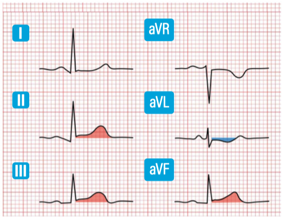 Semistemi
